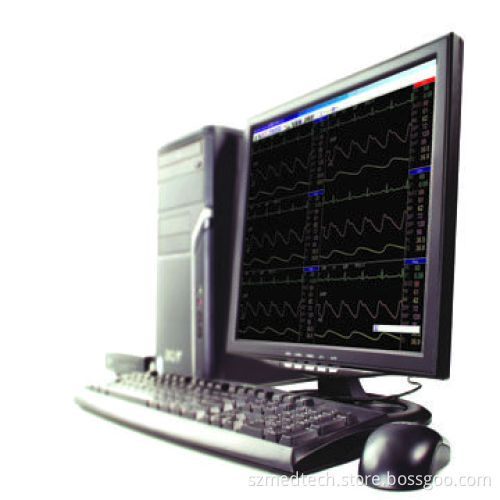 Hospital ICU Central Monitoring System with Audio and Visual Alarm Limit Control